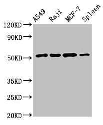 Polyclonal Rabbit anti-Human Antithrombin-III Antibody (IHC, WB)