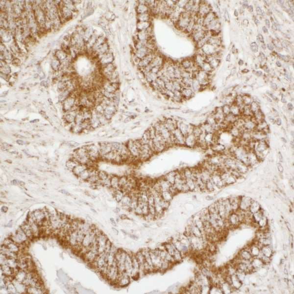 Polyclonal Rabbit anti-Human ATP5A1 / ATP Synthase Alpha Antibody (aa175-225, IHC, WB)