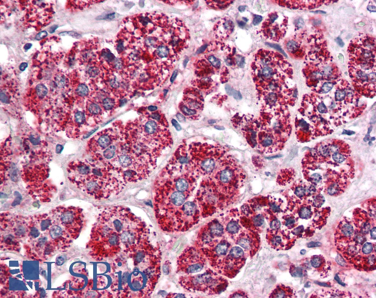 IHC-plus™ Renal Dipeptidase / DPEP1 Antibody (Internal, PE)