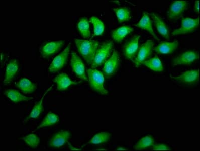DHX34 Antibody