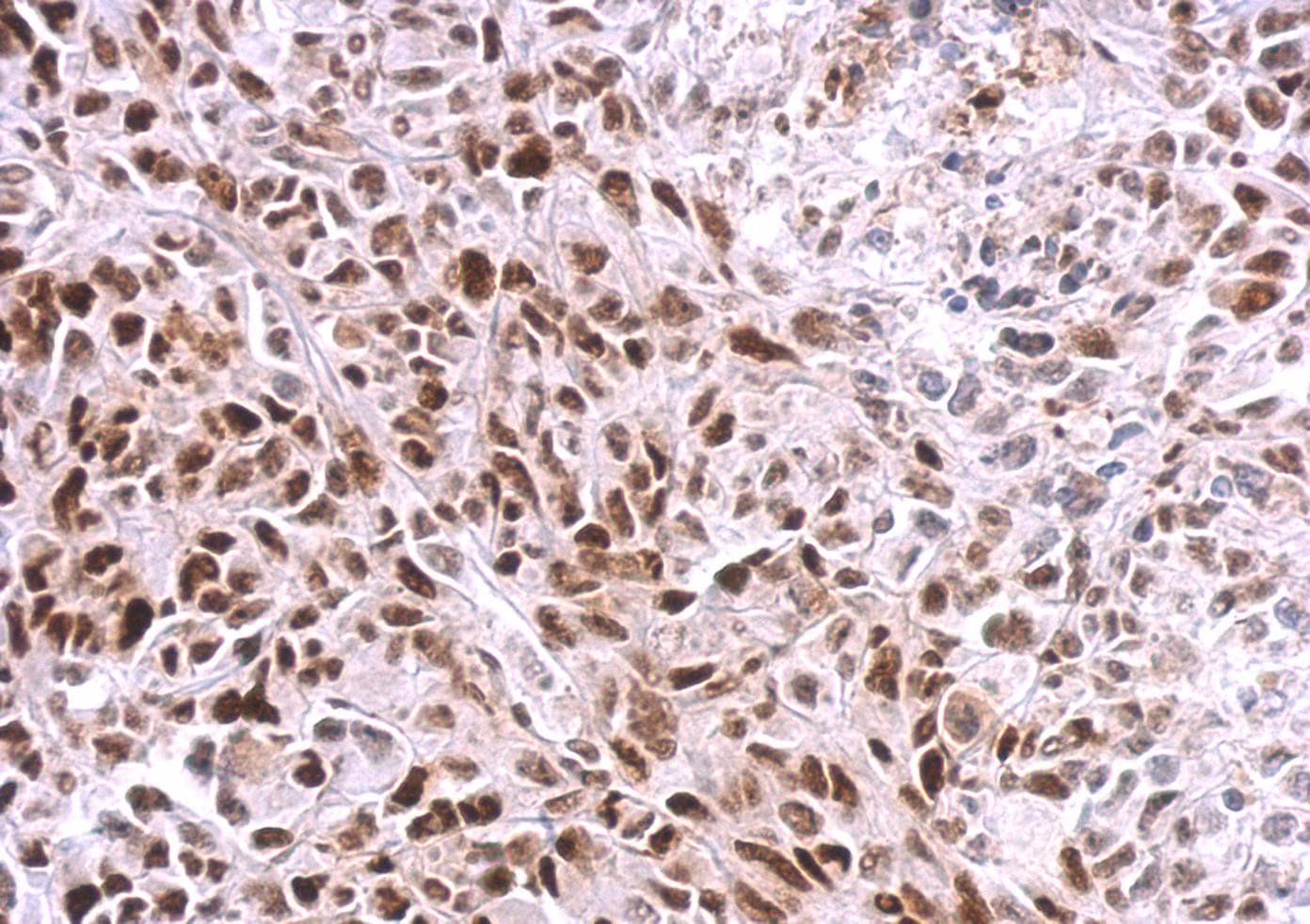 SAMHD1 Antibody (aa122-451)