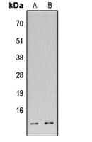 DFFA / ICAD / DFF45 Antibody (Internal)