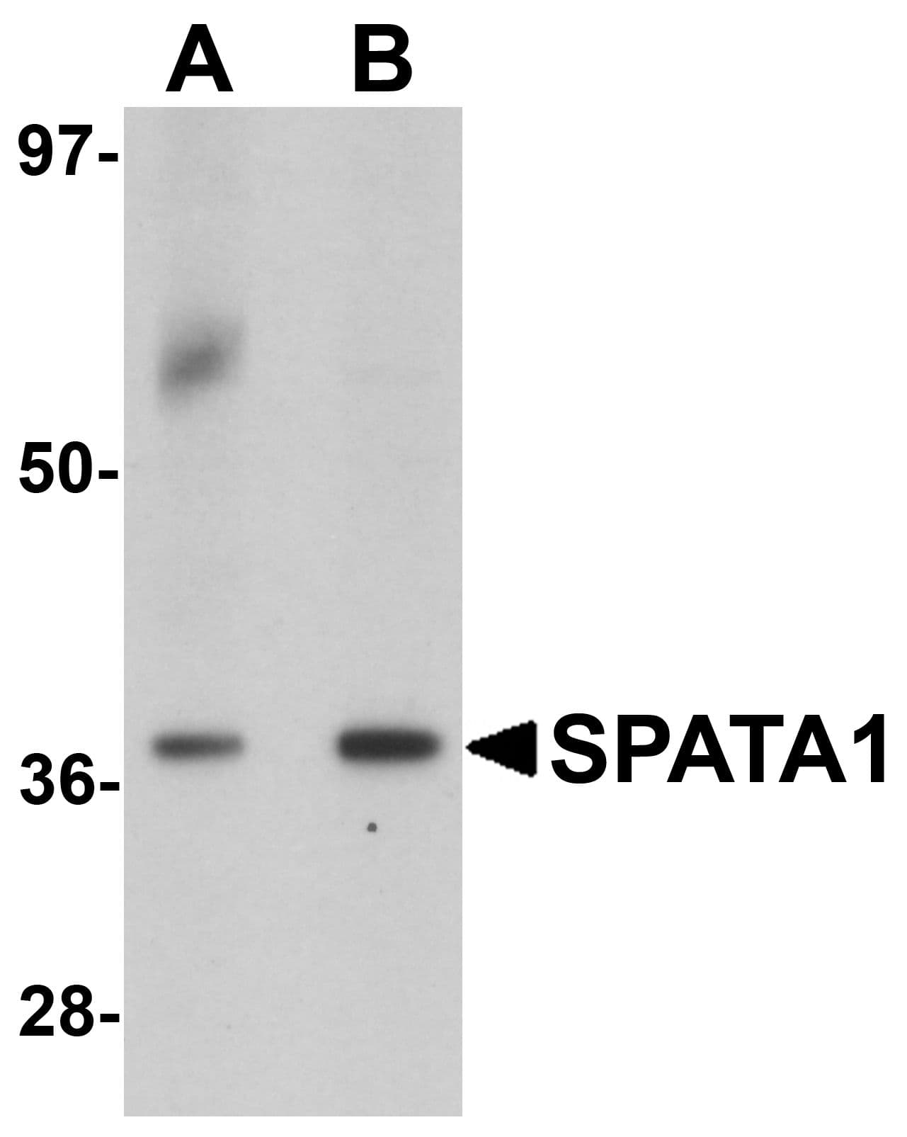 SP-2 / SPATA1 Antibody