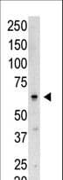 Polyclonal Rabbit anti-Human SENP3 Antibody (aa1-30, IHC, WB)