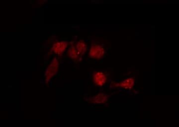 GPR87 Antibody
