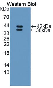Polyclonal Rabbit anti-Human RETNLB / RELM-Beta Antibody (aa24-111, WB)