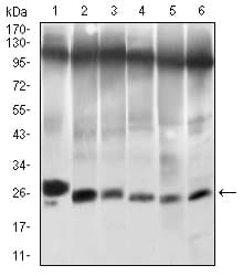 Monoclonal Mouse anti-Human TWIST1 / TWIST Antibody (clone 10E4E6, aa9-74, IHC, IF, WB)