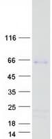 Human SHE Protein (Recombinant Myc-DDK (Flag))