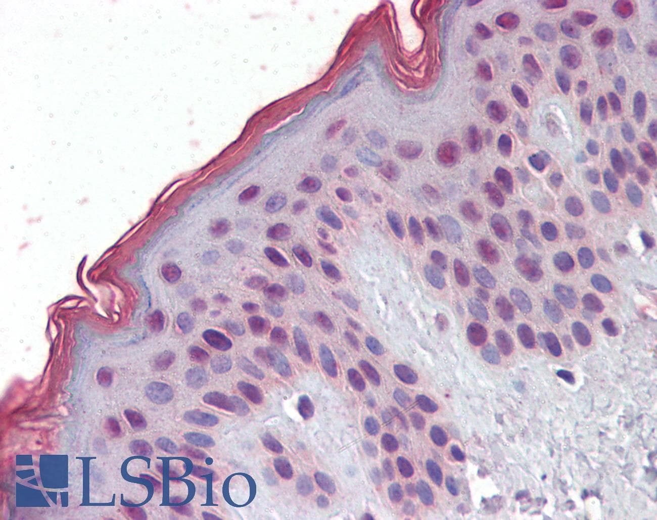 IHC-plus™ MBD2 Antibody (aa15-29)