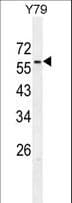 ZNF678 Antibody (aa489-518)