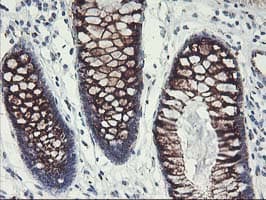 GOLM1 / GP73 / GOLPH2 Antibody (clone OTI4B12)