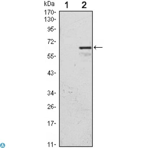 CDKN1C / p57 Kip2 Antibody