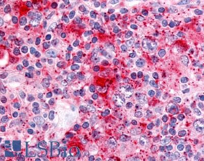 PathPlus™ CDC7 Antibody (Kinase Domain)
