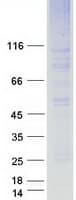 Human EMP2 Protein (Recombinant Myc-DDK (Flag))