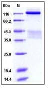 Human INSR / Insulin Receptor Protein (Recombinant His,C-terminus)