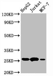 Recombinant Monoclonal Rabbit anti-Human BCL2 / Bcl-2 Antibody (IHC, WB)