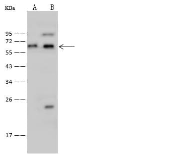 GLYR1 Antibody (Preservative Free)