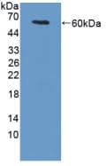 TGM1 / Transglutaminase Antibody (aa337-607)
