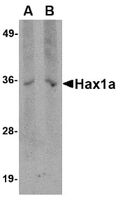 IHC-plus™ HAX-1 Antibody (clone 9F3D11)