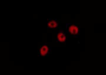 Polyclonal Rabbit anti-Human CHEK2 / CHK2 Antibody (phospho-Thr383, IHC, IF, WB)