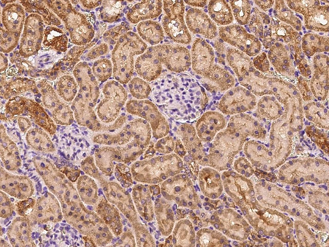 RHD Antibody (Preservative Free)