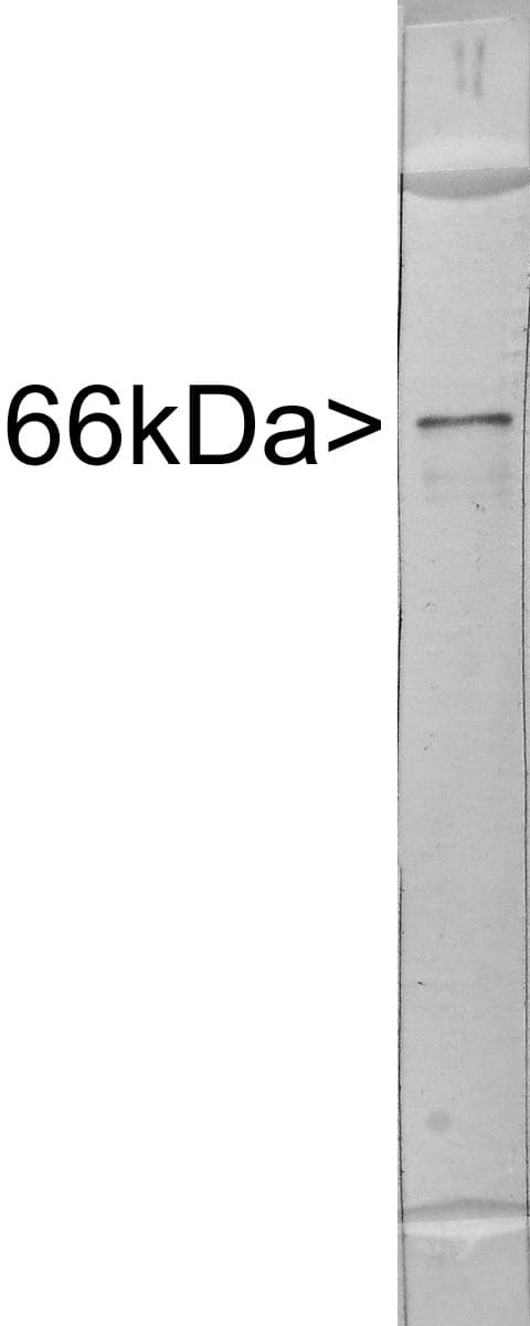 IHC-plus™ Polyclonal Chicken anti-Human INA / Alpha Internexin Antibody (IHC, IF, WB)