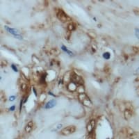 EIF4EBP1 / 4EBP1 Antibody (N-Terminus)