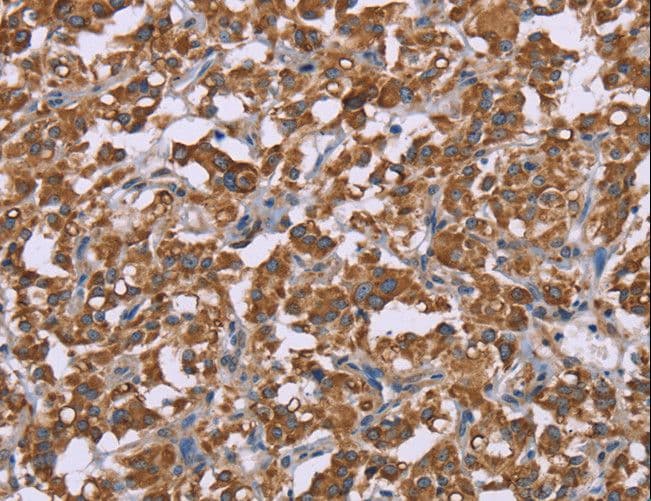 PPIF / Cyclophilin F Antibody