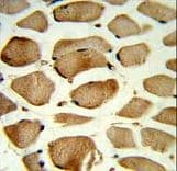 Polyclonal Rabbit anti-Human CAV2 / Caveolin 2 Antibody (aa11-44, IHC, IF, WB)