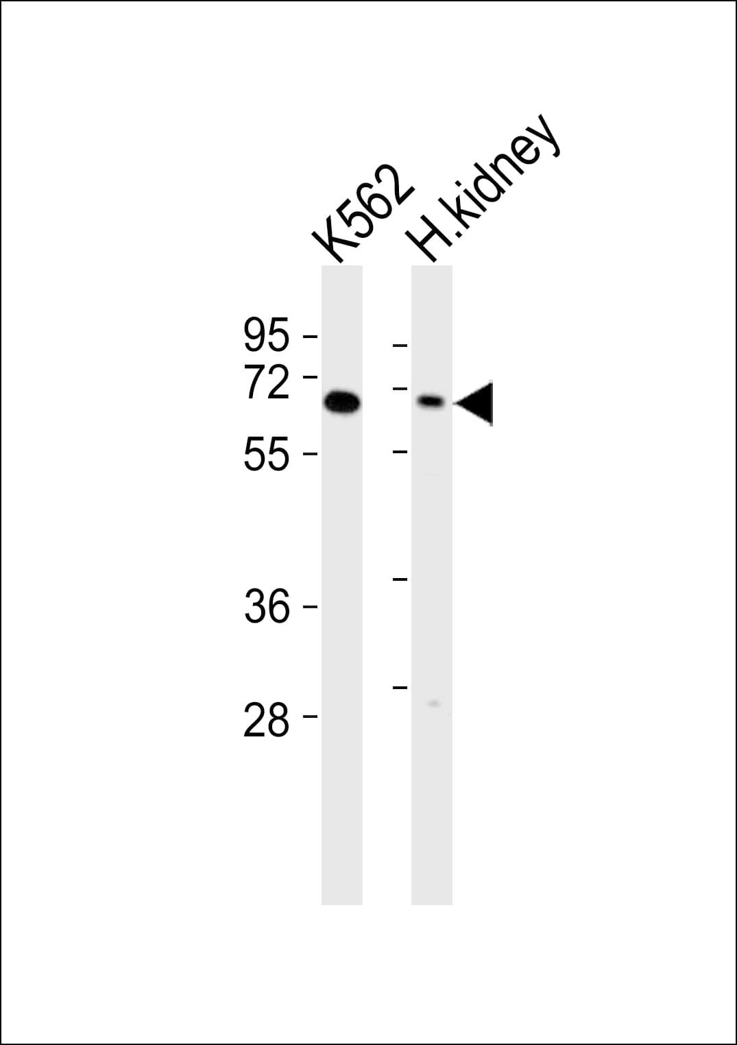 ARSD / Arylsulfatase D Antibody