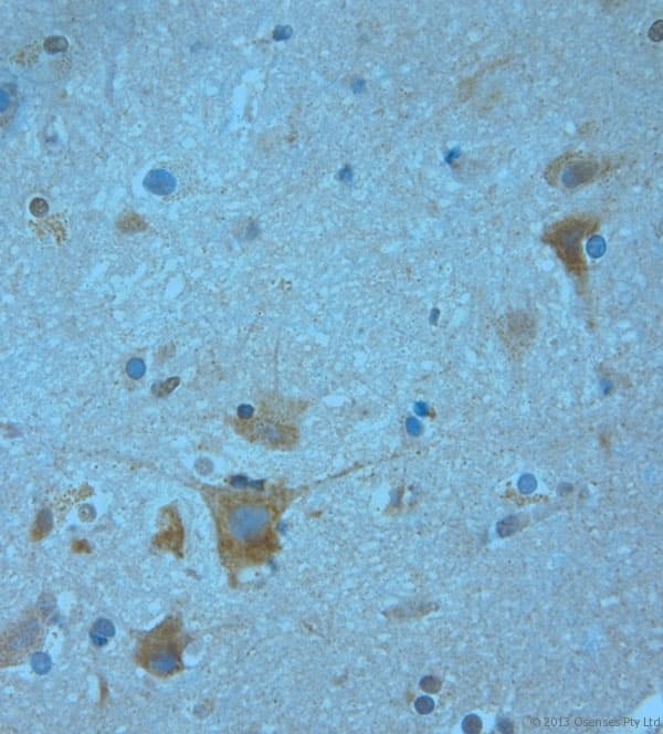 KCNJ13 / KIR7.1 Antibody (aa2-50)