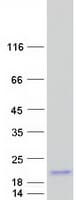 Human BEX5 Protein (Recombinant Myc-DDK (Flag))