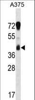 RCN1 / Reticulocalbin 1 Antibody (aa305-331)