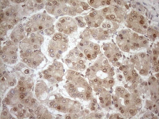 MGMT Antibody (clone OTI2E2, Carrier-free)
