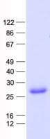 Human CBR4 Protein (Recombinant His, N-Terminal)