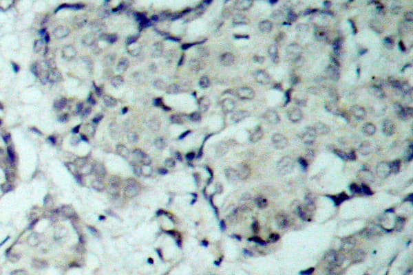 HDAC5 Antibody (phospho-Ser498)