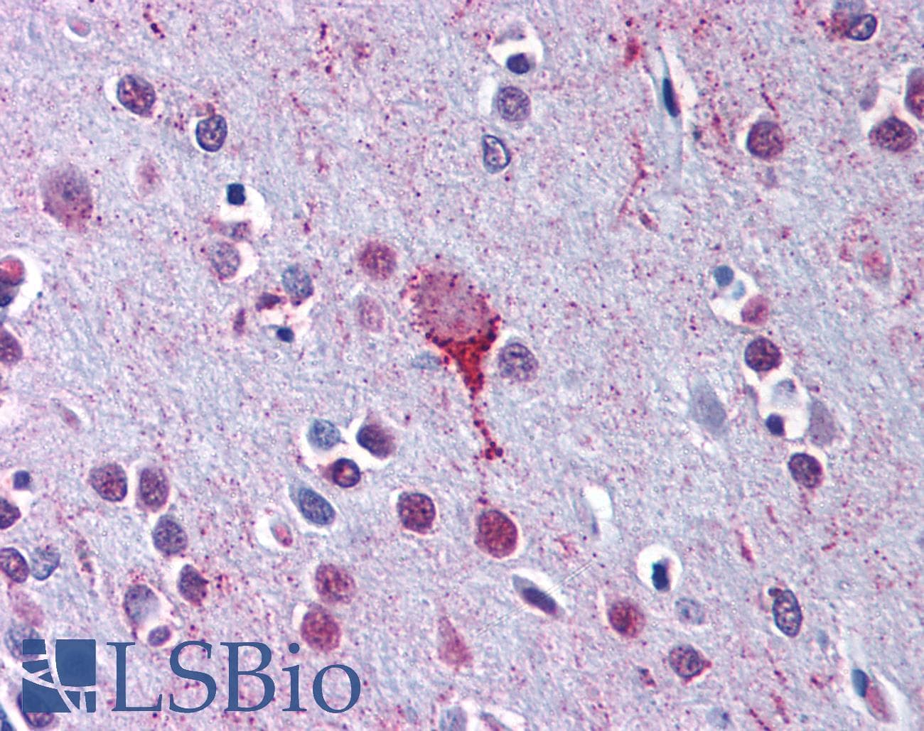 IHC-plus™ Polyclonal Rabbit anti-Human LPAR4 / GPR23 Antibody (C-Terminus, IHC)