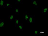 DDX5 Antibody (clone 2257C3a)