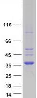 Human CDYL Protein (Recombinant Myc-DDK (Flag))