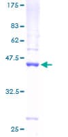 Human C1D Protein (Recombinant GST)