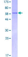 Human DCN / Decorin Protein (Recombinant GST)