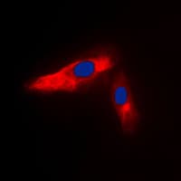 ACTN3 Antibody (N-Terminus)
