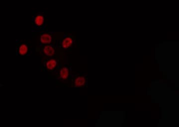 TRA2A Antibody