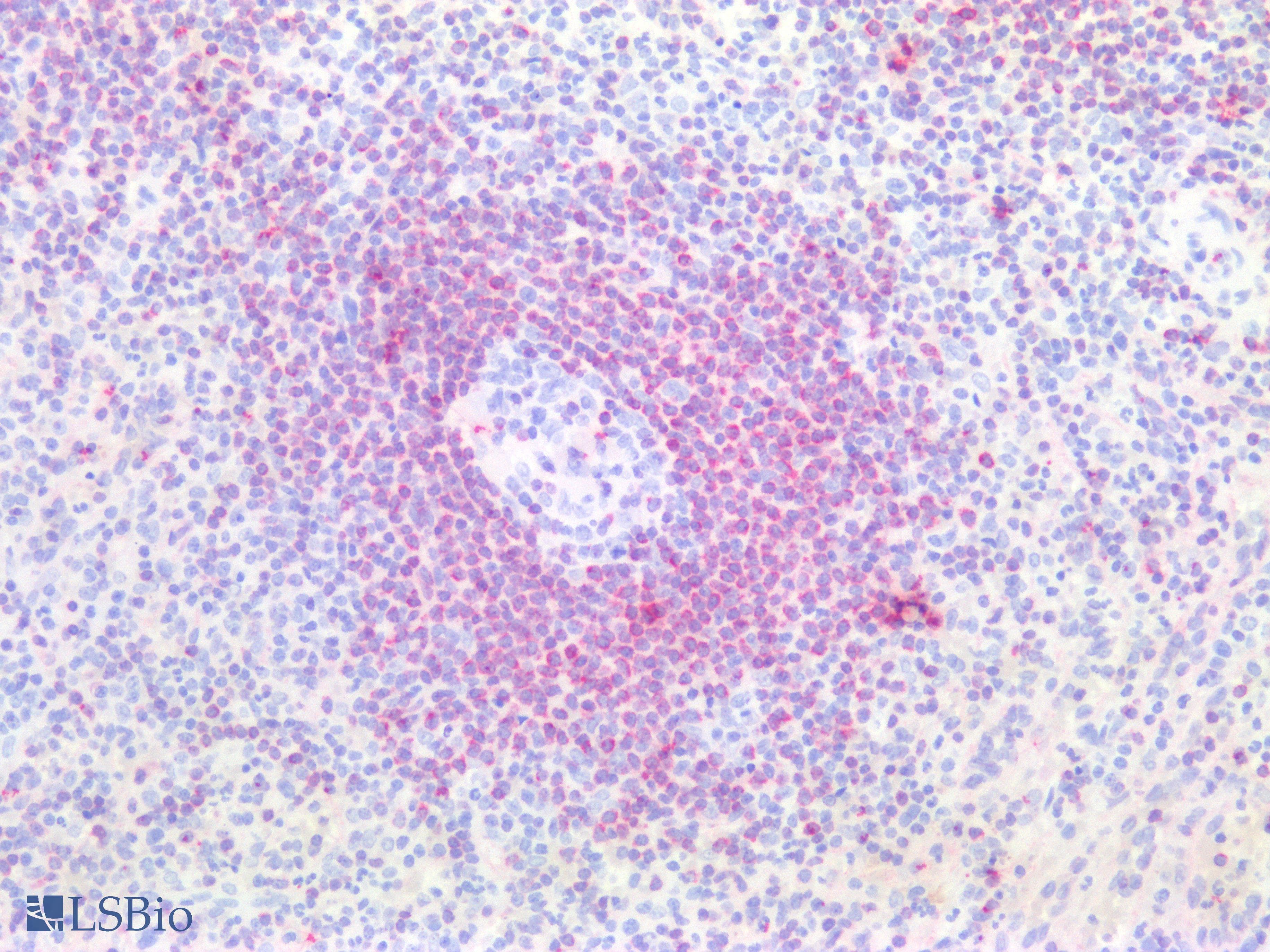 IHC-plus™ Monoclonal Mouse anti-Human BCL2 / Bcl-2 Antibody (clone Bcl-2/100, aa41-54, IHC, WB)