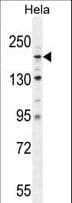 IHC-plus™ Polyclonal Rabbit anti-Human COL4A2 / Collagen IV Alpha2 Antibody (aa156-186, IHC, WB)