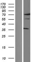 NFYC Protein (Over-Expression Lysate Myc-DDK (Flag))