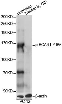BCAR1 / p130Cas Antibody (phospho-Tyr165)