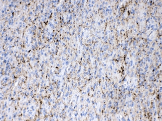 SYN1 / Synapsin 1 Antibody
