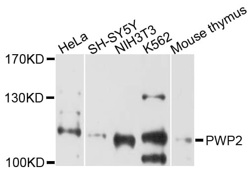 Polyclonal Rabbit anti-Human PWP2H / PWP2 Antibody (WB)