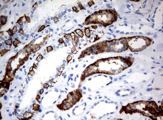 CA12 / Carbonic Anhydrase XII Antibody (clone UMAB121)